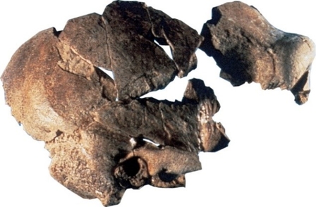 La photo représente des fragments de la boite crânienne et du haut de la face.