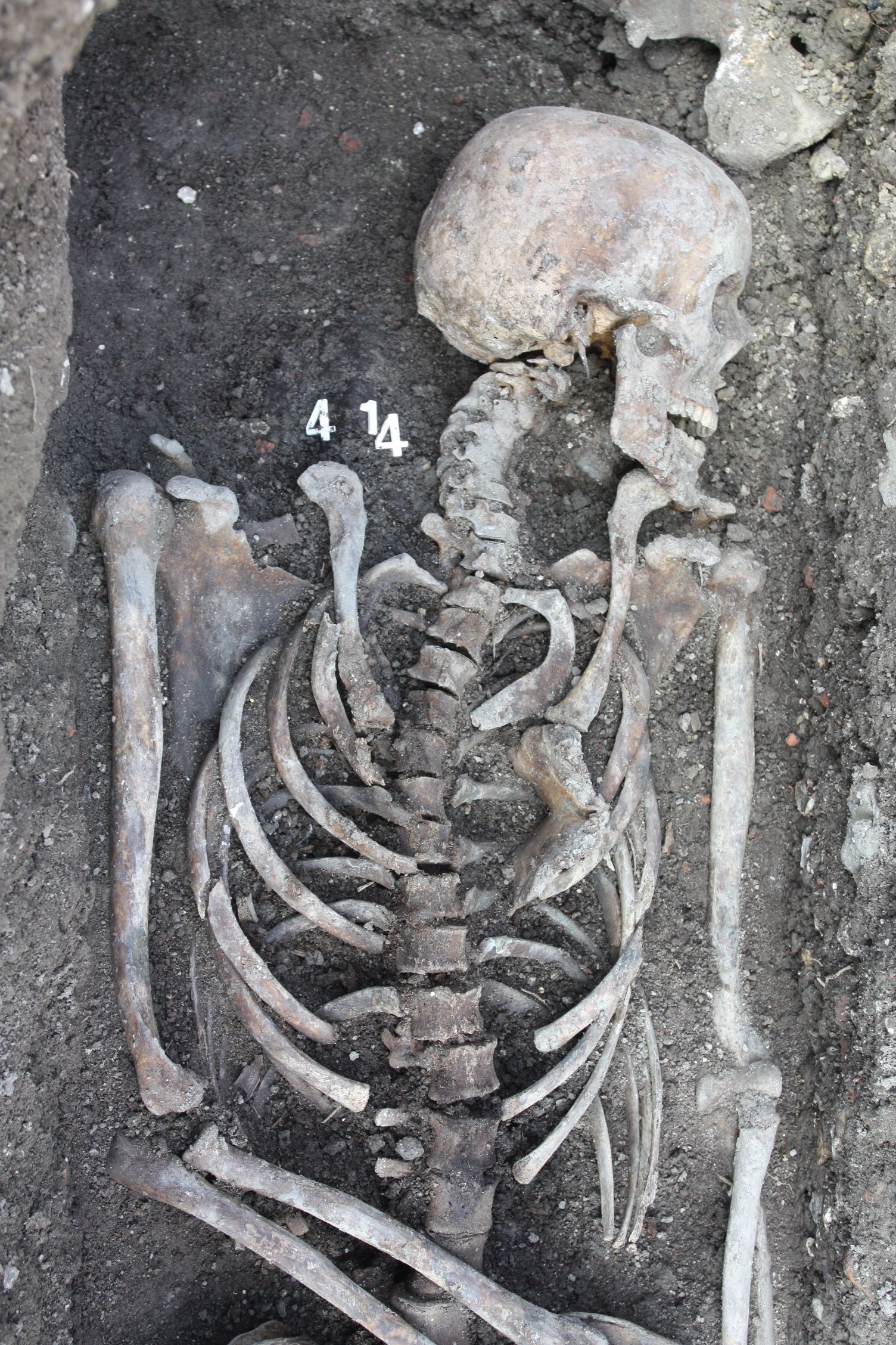 la colonne vertébrale dessine un S